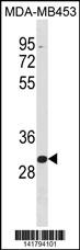 ZNF367 Antibody (C-term) (Cat. #AP19915b) western blot analysis in MDA-MB453 cell line lysates (35ug/lane).This demonstrates the ZNF367 antibody detected the ZNF367 protein (arrow).