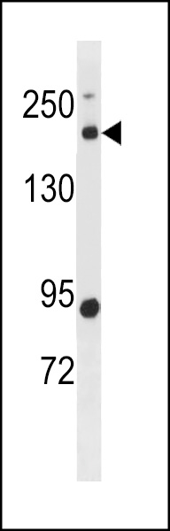 BCL9L Antibody (N-term) (Cat. #AP19875a) western blot analysis in human placenta tissue lysates (35ug/lane).This demonstrates the BCL9L antibody detected the BCL9L protein (arrow).