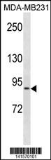 KIRREL Antibody (C-term) (Cat. #AP19861b) western blot analysis in MDA-MB231 cell line lysates (35ug/lane).This demonstrates the KIRREL antibody detected the KIRREL protein (arrow).