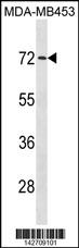 MEX3C Antibody (C-term) (Cat. #AP20253b) western blot analysis in MDA-MB453 cell line lysates (35ug/lane).This demonstrates the MEX3C antibody detected the MEX3C protein (arrow).