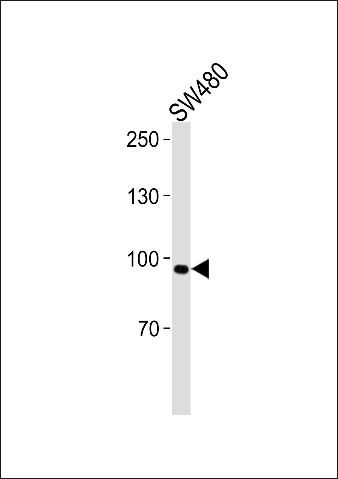ANO6 Antibody (N-term) (Cat. #AP20252a) western blot analysis in SW480 cell line lysates (35ug/lane).This demonstrates the ANO6 antibody detected the ANO6 protein (arrow).
