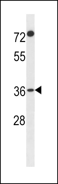 F110A Antibody (N-term) (Cat. #AP20248a) western blot analysis in A2058 cell line lysates (35ug/lane).This demonstrates the F110A antibody detected the F110A protein (arrow).