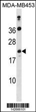 ATP5S Antibody (N-term) (Cat. #AP20241a) western blot analysis in MDA-MB453 cell line lysates (35ug/lane).This demonstrates the ATP5S antibody detected the ATP5S protein (arrow).