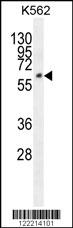 FAM155A Antibody (N-term) (Cat. #AP10140a) western blot analysis in K562 cell line lysates (35ug/lane).This demonstrates the FAM155A antibody detected the FAM155A protein (arrow).