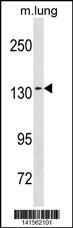 SEC31A Antibody (Center) (Cat. #AP20163c) western blot analysis in mouse lung tissue lysates (35ug/lane).This demonstrates the SEC31A antibody detected the SEC31A protein (arrow).