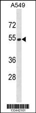 HERPUD2 Antibody (C-term) (Cat. #AP20139b) western blot analysis in A549 cell line lysates (35ug/lane).This demonstrates the HERPUD2 antibody detected the HERPUD2 protein (arrow).