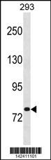 CHM Antibody (Center) (Cat. #AP20084c) western blot analysis in 293 cell line lysates (35ug/lane).This demonstrates the CHM antibody detected the CHM protein (arrow).