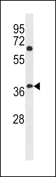 NHLRC3 Antibody (C-term) (Cat. #AP20054b) western blot analysis in NCI-H460 cell line lysates (35ug/lane).This demonstrates the NHLRC3 antibody detected the NHLRC3 protein (arrow).