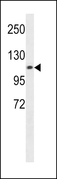 CHSY3 Antibody (Center) (Cat. #AP20033c) western blot analysis in A549 cell line lysates (35ug/lane).This demonstrates the CHSY3 antibody detected the CHSY3 protein (arrow).