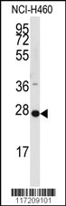 Western blot analysis of anti-PPAP2C Antibody (C-term) (Cat.#AP2799b) in NCI-H460 cell line lysates (35ug/lane).PPAP2C(arrow) was detected using the purified Pab.