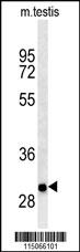 ITGB1BP3 Antibody (Center) (Cat. #AP2791c) western blot analysis in mouse testis tissue lysates (35ug/lane).This demonstrates ITGB1BP3 antibody detected ITGB1BP3 protein (arrow).