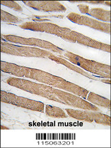 Formalin-fixed and paraffin-embedded human skeletal muscle tissue reacted with ITGB1BP3 antibody (N-term) (Cat.#AP2791a), which was peroxidase-conjugated to the secondary antibody, followed by DAB staining. This data demonstrates the use of this antibody for immunohistochemistry; clinical relevance has not been evaluated.