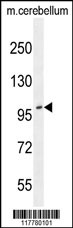ADAMTS10 Antibody (N-term) (Cat. #AP10102a) western blot analysis in mouse cerebellum tissue lysates (35ug/lane).This demonstrates the ADAMTS10 antibody detected the ADAMTS10 protein (arrow).