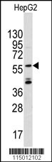 Western blot analysis of anti-ANGEL2 Pab (Cat.#AP2749c) in CEM cell line lysates (35ug/lane). ANGEL2 (arrow) was detected using the purified Pab.