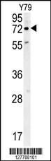 RFT1 Antibody (C-term) (Cat. #AP10088b) western blot analysis in Y79 cell line lysates (35ug/lane).This demonstrates the RFT1 antibody detected the RFT1 protein (arrow).