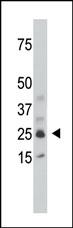 The anti-SULT1C1 Pab (Cat. #AP2602b) is used in Western blot to detect SULT1C1 in mouse kidney tissue lysate.