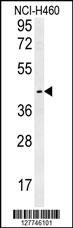LAPTM5 Antibody (N-term) (Cat. #AP10077a) western blot analysis in NCI-H460 cell line lysates (35ug/lane).This demonstrates the LAPTM5 antibody detected the LAPTM5 protein (arrow).