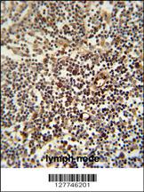 LAPTM5 antibody (N-term) (Cat. #AP10077a) immunohistochemistry analysis in formalin fixed and paraffin embedded human lymph node followed by peroxidase conjugation of the secondary antibody and DAB staining. This data demonstrates the use of the LAPTM5 antibody (N-term) for immunohistochemistry. Clinical relevance has not been evaluated.