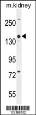 COBL Antibody (N-term) (Cat. #AP10402a) western blot analysis in mouse kidney tissue lysates (35ug/lane).This demonstrates the COBL antibody detected the COBL protein (arrow).