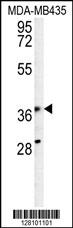 KPRA Antibody (N-term) (Cat. #AP10399a) western blot analysis in MDA-MB435 cell line lysates (35ug/lane).This demonstrates the KPRA antibody detected the KPRA protein (arrow).