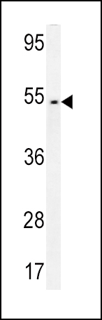 FAM46A Antibody (Center) (Cat. #AP10394c) western blot analysis in CEM cell line lysates (35ug/lane).This demonstrates the FAM46A antibody detected the FAM46A protein (arrow).