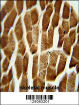 AP1S3 antibody (N-term) (Cat. #AP10390a) immunohistochemistry analysis in formalin fixed and paraffin embedded human skeletal muscle followed by peroxidase conjugation of the secondary antibody and DAB staining. This data demonstrates the use of the AP1S3 antibody (N-term) for immunohistochemistry. Clinical relevance has not been evaluated.