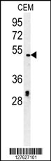 DCC1 Antibody (C-term) (Cat. #AP2874b) western blot analysis in CEM cell line lysates (35ug/lane).This demonstrates the DCC1 antibody detected the DCC1 protein (arrow).