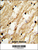 Formalin-fixed and paraffin-embedded human brain tissue with DCC1 Antibody (N-term), which was peroxidase-conjugated to the secondary antibody, followed by DAB staining. This data demonstrates the use of this antibody for immunohistochemistry; clinical relevance has not been evaluated.