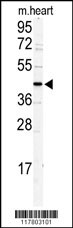 Western blot analysis of DCC1 antibody (N-term) (Cat.#AP2874a) in mouse heart tissue lysates (35ug/lane). DCC1 (arrow) was detected using the purified Pab.