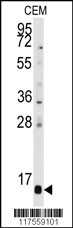 Western blot analysis of anti-PFDN6 Antibody (N-term) (Cat.#AP2836a) in CEM cell line lysates (35ug/lane). PFDN6 (arrow) was detected using the purified Pab.