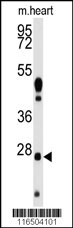 Western blot analysis of anti-WDYHV1 Antibody (Center) Pab (Cat.#AP2809c) in mouse heart tissue lysates (35ug/lane). WDYHV1(arrow) was detected using the purified Pab.