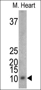 The anti-Mouse Phospho-PLM-pS88 Pab (Cat. #AP3286a) is used for detection in mouse heart tissue lysate. Mouse Phospho-PLM-pS88 (arrow) was detected using the purified Pab.