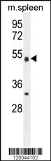 METTL4 Antibody (C-term) (Cat. #AP10377b) western blot analysis in mouse spleen tissue lysates (35ug/lane).This demonstrates the METTL4 antibody detected the METTL4 protein (arrow).