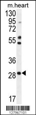 RNF183 Antibody (Center) (Cat. #AP10358c) western blot analysis in mouse heart tissue lysates (35ug/lane).This demonstrates the RNF183 antibody detected the RNF183 protein (arrow).
