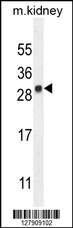 LYPD4 Antibody (Center) (Cat. #AP10344c) western blot analysis in mouse kidney tissue lysates (35ug/lane).This demonstrates the LYPD4 antibody detected the LYPD4 protein (arrow).