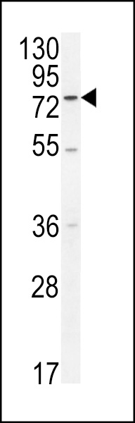 ENTHD1 Antibody (N-term) (Cat. #AP10335a) western blot analysis in A2058 cell line lysates (35ug/lane).This demonstrates the ENTHD1 antibody detected the ENTHD1 protein (arrow).