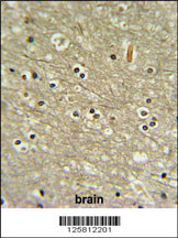 WDR82 Antibody (N-term) (Cat. #AP4812a) IHC analysis in formalin fixed and paraffin embedded human brain tissue followed by peroxidase conjugation of the secondary antibody and DAB staining. This data demonstrates the use of the WDR82 Antibody (N-term) for immunohistochemistry. Clinical relevance has not been evaluated.