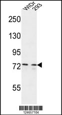 CEP63 Antibody (Center) (Cat. #AP4805c) western blot analysis in WiDr,293 cell line lysates (35ug/lane).This demonstrates the CEP63 antibody detected the CEP63 protein (arrow).