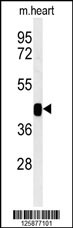 Western blot analysis of B3GNT7 Antibody (Center) (Cat. #jpg) in mouse heart tissue lysates (35ug/lane). B3GNT7 (arrow) was detected using the purified Pab.