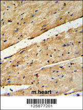 B3GNT7 Antibody (Center) (Cat. #AP4793c) IHC analysis in formalin fixed and paraffin embedded mouse heart tissue followed by peroxidase conjugation of the secondary antibody and DAB staining. This data demonstrates the use of the B3GNT7 Antibody (Center) for immunohistochemistry. Clinical relevance has not been evaluated.