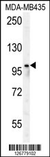 PARP8 Antibody (Center) (Cat. #AP4779c) western blot analysis in MDA-MB435 cell line lysates (35ug/lane).This demonstrates the PARP8 antibody detected the PARP8 protein (arrow).