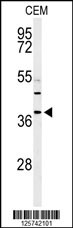 Western blot analysis of RNASEH2B Antibody (Center) (Cat. #AP4774c) in CEM cell line lysates (35ug/lane). RNASEH2B (arrow) was detected using the purified Pab.