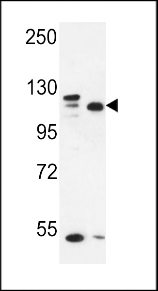 SEC24C Antibody (Center) (Cat. #AP4773c) western blot analysis in MDA-MB435,MCF-7 cell line lysates (35ug/lane).This demonstrates the SEC24C antibody detected the SEC24C protein (arrow).