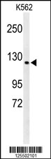 Western blot analysis of CQ068 Antibody (Center) (Cat. #AP4761c) in K562 cell line lysates (35ug/lane). CQ068 (arrow) was detected using the purified Pab.