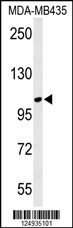 Western blot analysis of LUZP1 Antibody (C-term) (Cat. #AP4711b) in MDA-MB435 cell line lysates (35ug/lane). LUZP1 (arrow) was detected using the purified Pab.