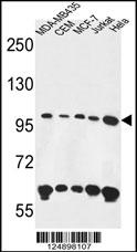 ANKFY1 Antibody (C-term) (Cat. #AP4704b) western blot analysis in MDA-MB435,CEM,MCF-7,Jurkat,Hela cell line lysates (35ug/lane).This demonstrates the ANKFY1 antibody detected the ANKFY1 protein (arrow).