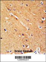 ANKFY1 Antibody (C-term) (Cat. #AP4704b) immunohistochemistry analysis in formalin fixed and paraffin embedded human brain tissue followed by peroxidase conjugation of the secondary antibody and DAB staining. This data demonstrates the use of the ANKFY1 Antibody (C-term) for immunohistochemistry. Clinical relevance has not been evaluated.
