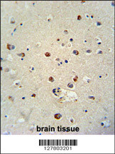 RILPL1 antibody (C-term) (Cat. #AP10297b) immunohistochemistry analysis in formalin fixed and paraffin embedded human brain tissue followed by peroxidase conjugation of the secondary antibody and DAB staining. This data demonstrates the use of the RILPL1 antibody (C-term) for immunohistochemistry. Clinical relevance has not been evaluated.