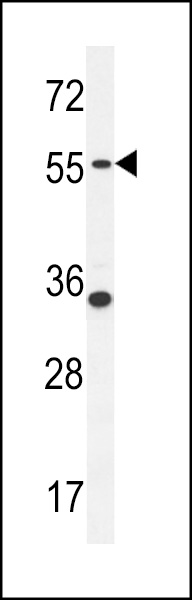 PDE12 Antibody (C-term) (Cat. #AP10288b) western blot analysis in MDA-MB231 cell line lysates (35ug/lane).This demonstrates the PDE12 antibody detected the PDE12 protein (arrow).