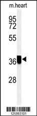 Western blot analysis of CCDC42 Antibody (Center) (Cat. #AP5019c) in mouse heart tissue lysates (35ug/lane).CCDC42 (arrow) was detected using the purified Pab.